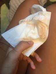 In that case, if you find this kind of symptom during pregnant, you have to do something in order to make you feel in the first pregnancy by week, the baby will not be seen clearly. Blood Discharge During Pregnancy 8 Weeks