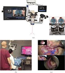 4.2 out of 5 stars 309 ratings. Comprehensive Review Of Surgical Microscopes Technology Development And Medical Applications