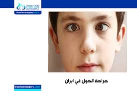 كم تستغرق عملية تصحيح الحول للكبار علاج الحول عند الكبار عملية حول العين للكبار علاج الحول