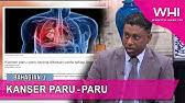 Ia jarang berlaku pada orang di bawah umur 45. Myhealth Kanser Paru Paru Youtube