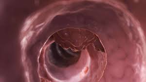Denn nicht nur größere tumore können tochtergeschwülste bilden. Neue Fruhtests Gegen Darmkrebs Wissen