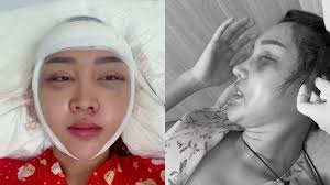 Selain Ingin Cantik, Inilah Alasan Lucinta Luna Terus Lakukan Operasi  Plastik Meski Takut Mati