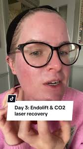 Tips for Wallpapering a Ceiling Like a Pro