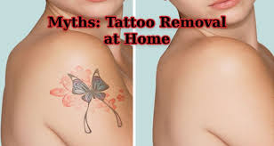 The average time to remove a professionally applied tattoo ranges from 9 months to 18 months. Myth Tattoo Removal At Home Remedies Trending Tattoo