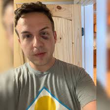 Long Lake was lovely, black eye and all.