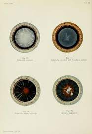 Atlas Of External Diseases Of The Eye Dr Richard Greeff 1914 Diseases Of The Eye Vision Eye Matter Science