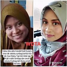 ADA MASALAH #JERAWAT,#JERAGAT,#PARUT,#KULIT KUSAM wajib try produk ni. .  BUKAN JANJI TAPI PASTI! SEMUA TERPAKSA CANTIK AWETMUDA! 💖 UMUR 30,40, 50,  70 TAHUN,PAKAI PUN BOLEH JADI AWET MUDA . ❌payah suntik-suntik