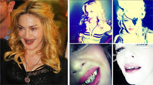 Whether you have one or many teeth out of place, chances are that you have considered braces. Sarah Vine Madonna S Teeth Grills Have Got To Go