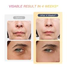 IBORRIA Aura2 Pro Multipolar 2MHz Radiofrecuencia Facial, 6 in 1 Masajeador  Facial Electrico Cara Masaje, Masajeador Facial Microcorriente, Anti-edad,  Rejuvenecimiento De La Piel Desde Casa (blanco) : Amazon.es: Belleza