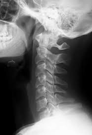 Eksi Duyuru Kategori Medikal