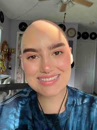 Fundraiser by Jordan Hemond : Jordan's surgery and treatment