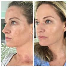 Tca provides a better way for banks to manage compliance. Tca Peel 3002 Dr Monica Scheel Dermatology