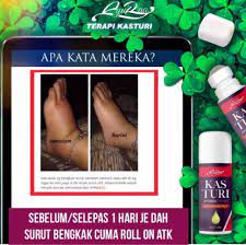 Apa saja alasan pergelangan kaki bengkak? Ubat Sapu Berkesan Untuk Bengkak Gout Masalah Gangguan Shopee Malaysia