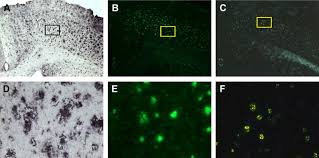 Microorganisms produce functional amyloids that can be examined and manipulated in vivo and in vitro. Histological Staining Of Amyloid And Pre Amyloid Peptides And Proteins In Mouse Tissue Abstract Europe Pmc