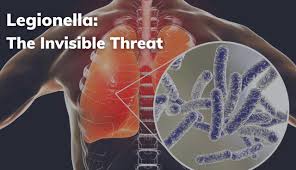 Image result for Legionella