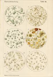 Antique Urology Print Crystalluria Kidney Stones Etsy Medical Decor Urologists Medical Gifts