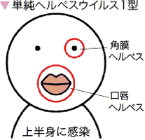 小児の感染症と予防 | 医療法人 羊蹄会 本部サイト