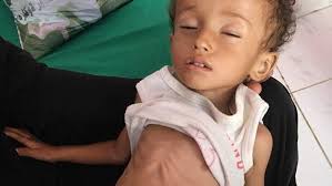 Yemen cholera epidemic: Cases exceed 500,000 in four months