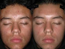Pin On Maxi Peel 3 Results