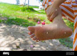 Nahaufnahme von Frau nackten Fuß leiden unter schmerzhaften Zehen. Nach  einem Spaziergang im Stream Wasser. Hochauflösende Bilder Galerie  Stockfotografie - Alamy