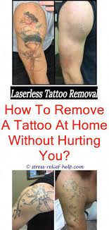 Best Laser For Tattoo Removal How Hard Is It To Get A Tattoo Removed Laser Tattoo Removal San Antonio Ta Tatowierungen Temporare Tatowierung Tattooentfernung