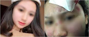 Hà Nội: Người vợ xinh đẹp “tố” bị chồng đánh rách đầu, mang bầu cũng hành hung  không tha