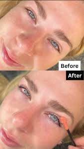 Looking for content models for the below treatments