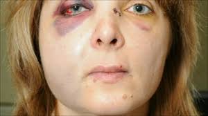 Aston train attack woman makes appeal