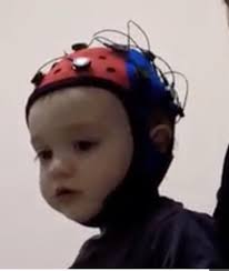 The Baby's First Years Study