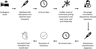 Image result for Dobutamine