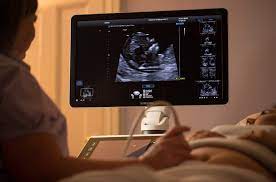 A dating scan might be recommended before 12 weeks to confirm your due date if you are unsure of your last menstrual period or your date of conception. 12 14 Week Scan Women S Imaging