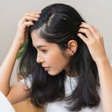 Deep Dive into Androgenetic Alopecia and the Treatments