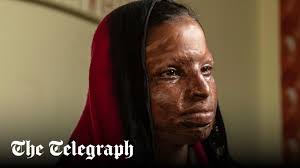 I don't want pity... I'm self-sufficient': Café gives fresh start to acid  attack survivors