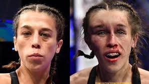Born august 18, 1987) is a polish professional mixed martial artist and former muay thai kickboxer. Ufc 248 Joanna Jedrzejczyk Faces Brutal Injury On Women S Day After Tough Fight