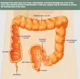 Image result