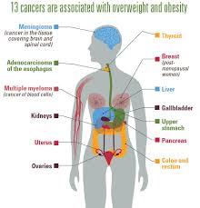 Genitourinary syndrome of menopause affects approximately 27% to 84% of postmenopausal women and can significantly impair there are insufficient data at present to confirm the safety of vaginal estrogen or dhea or ospemifene in women with breast cancer; Obesity And Cancer Cdc