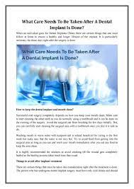 What food to avoid after a tooth juice, water, milk, coffee, tea. How Long After Dental Implant Can You Eat Regular Food Dental News Network