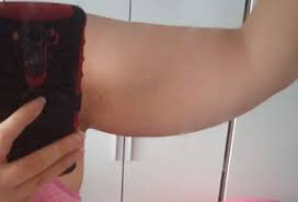 Bayanlarda Kol Sarkmasi Lutfen Yardim Edin Bodyforumtr Vucut Gelistirme Forumu