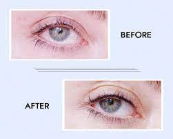 Eyeliner Tattoos Permanent Eyeliner Benefits Risks Cost