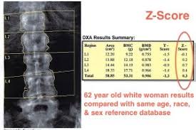 Z Score 4bonehealth