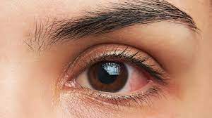 Augeninfarkt Symptome Ursachen Und Therapie Des Sehsturzes