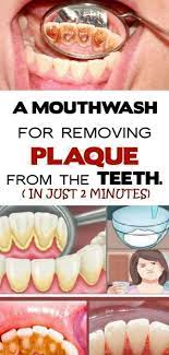 A Mouthwash For Removing Plaque From The Teeth Oral Care Routine Oral Care Mouthwash
