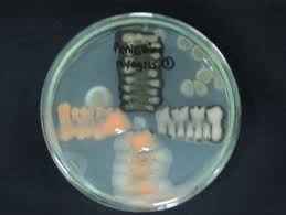 Image result for Schizozygia coffaeoides