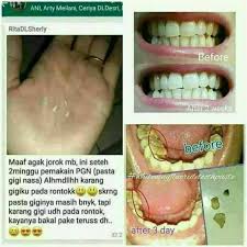 Super Whitening Teeth Tiens Orecare Toothpaste Odol Pemutih Gigi Perontok Karang Gigi Denta Care Original Lazada Indonesia