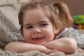 Girl without fingers or toes has ambitions to become a dancer