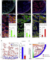 If you want to change the term, you must have bought compulsory third party (ctp) insurance for the same term. Apc Controls Asymmetric Wnt B Catenin Signaling And Cardiomyocyte Proliferation Gradient In The Heart Journal Of Molecular And Cellular Cardiology
