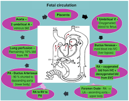 Image result for Delayed Transition from Fetal Circulation