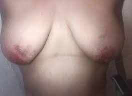 Beaten tits | MOTHERLESS.COM ™