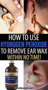 However, he says a trip to your doctor is best so that they can: How To Use Hydrogen Peroxide To Remove Ear Wax Earwax Produced By Our Ears Protect The Ear Canal From Infection A Clean Ear Wax Out Ear Cleaning Wax Ear Wax
