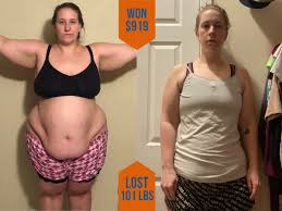 Pin On Amazing Before After Photos